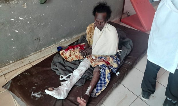 Ethiopia Air Strike in Northwest Tigray killed 56 people, Aid Workers Say