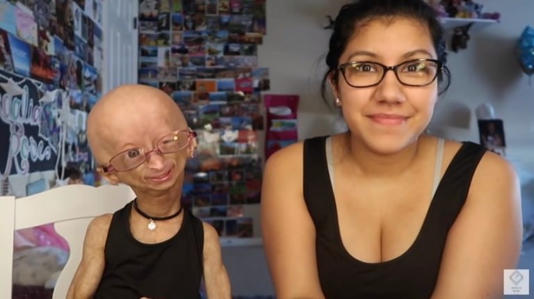 Adalia Rose Youtube Star With Early Aging Disorder Dies At 15 92130 Magazine